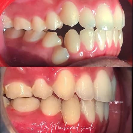 Orthodontics 5