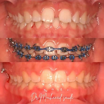 Orthodontics 6