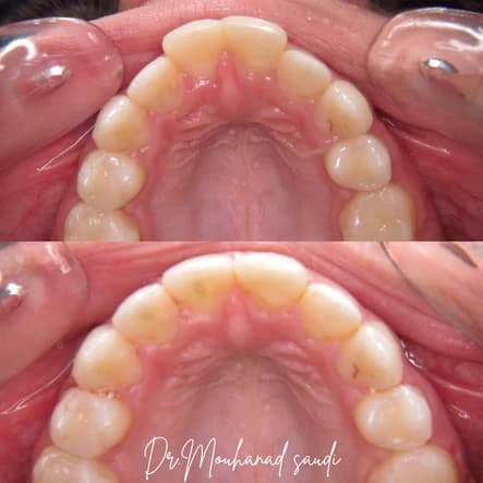 Orthodontics 8