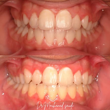 Orthodontics 9
