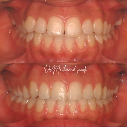 Orthodontics 10