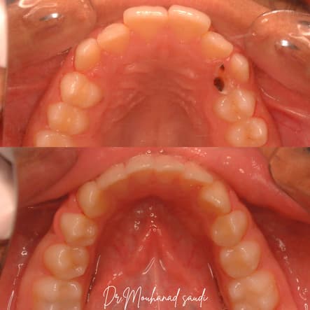 Orthodontics 11