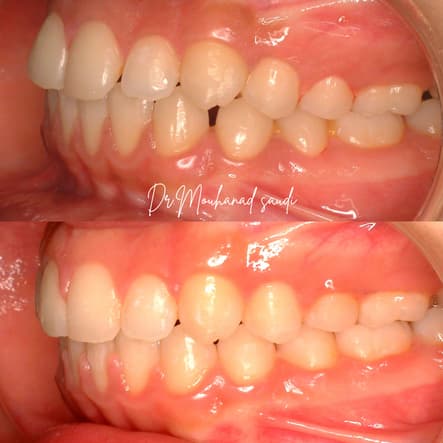 Orthodontics 12
